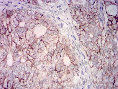 Валидация AntibodySystem RHJ71702