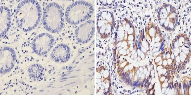 Валидация AssayVector ARM1504(1464)
