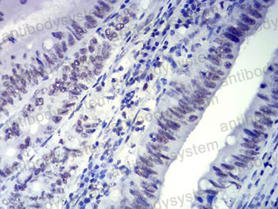 Валидация AntibodySystem RHN94003