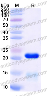 YHF69802, SDS-PAGE