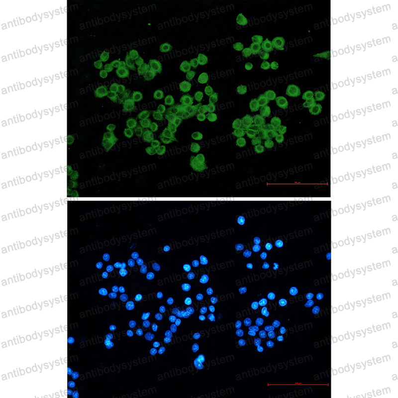 Валидация IF - AntibodySystem RHD90601