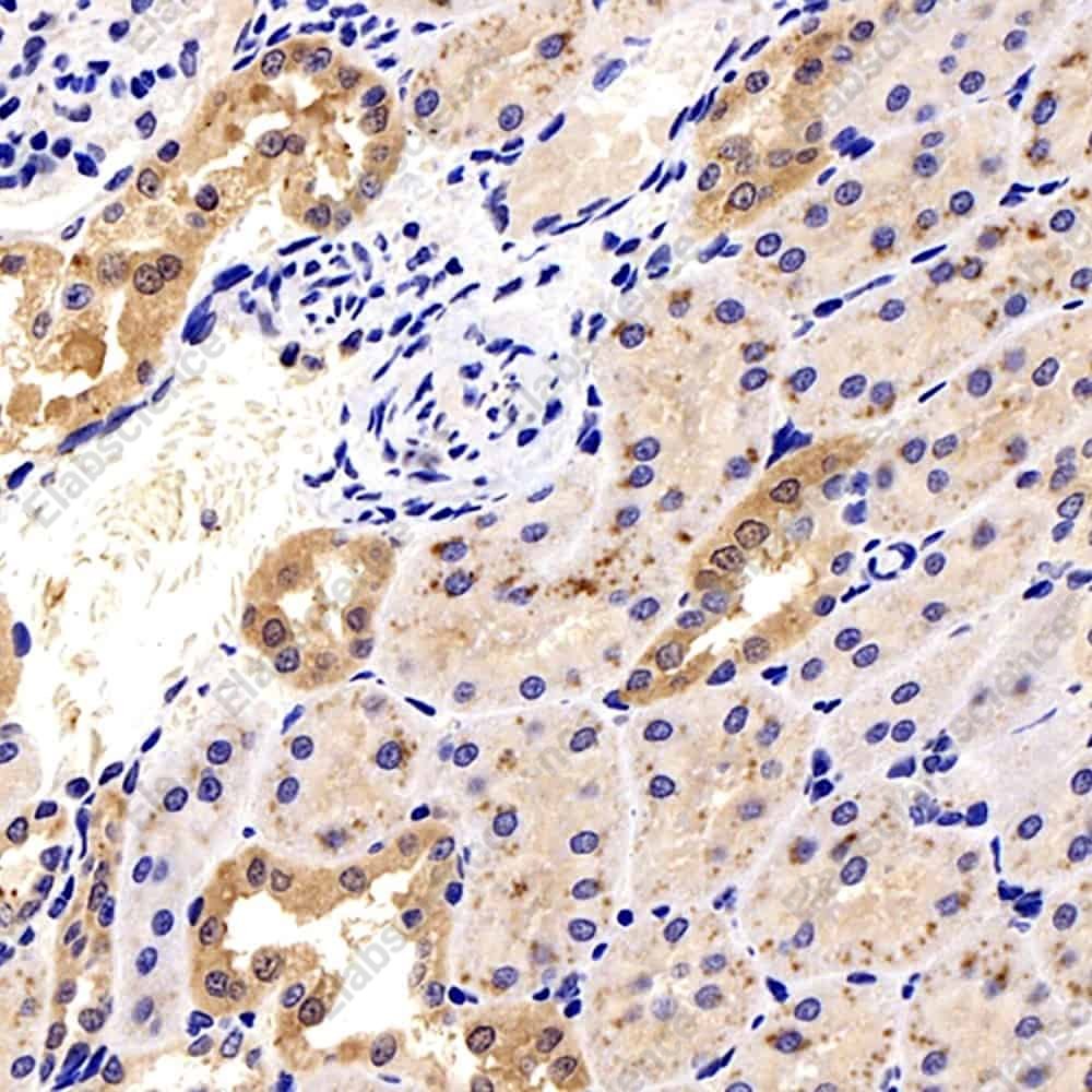 Иммуногистохимия, Galectin 3, ткань почки крысы