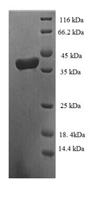 SDS-PAGE