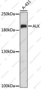 Вестерн-блоттинг, ALK, клетки A-431