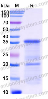 YHD24101, SDS-PAGE