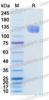 EHD08901, SDS-PAGE