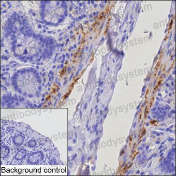 Валидация AntibodySystem RHD49203