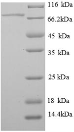 SDS-PAGE