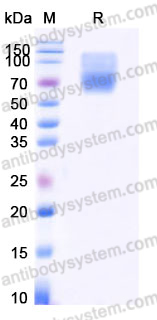 AHD89501, SDS-PAGE
