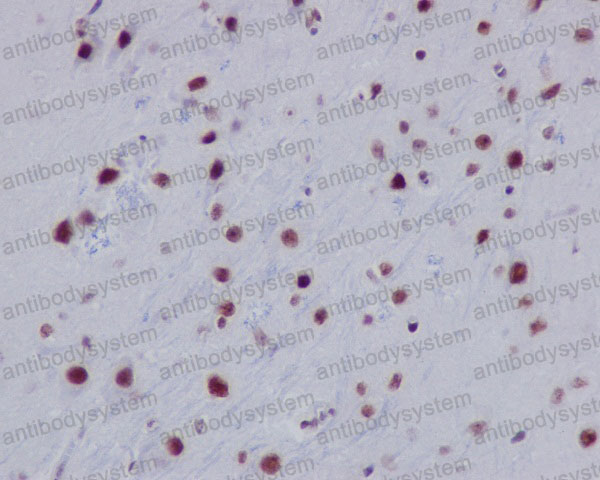 Валидация AntibodySystem RHC11301