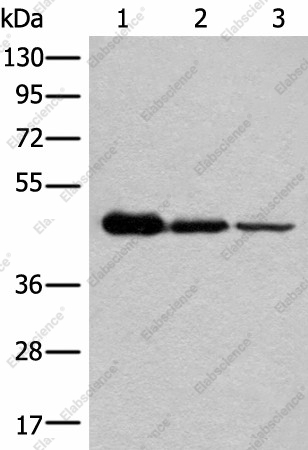 Вестерн-блоттинг, NADK2, клетки HEPG2, HeLa и A549