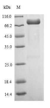 SDS-PAGE