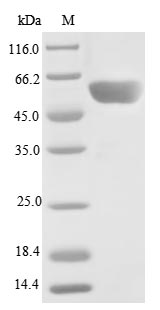 SDS-PAGE