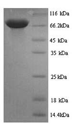 SDS-PAGE