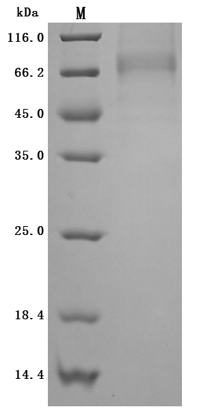 SDS-PAGE
