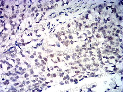 Валидация AntibodySystem RHF84504