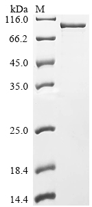 SDS-PAGE