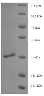 SDS-PAGE