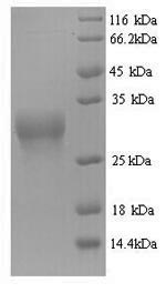 SDS-PAGE