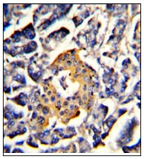 Валидация AssayVector ARM1663(1835)