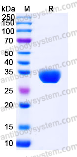 EHJ96201, SDS-PAGE