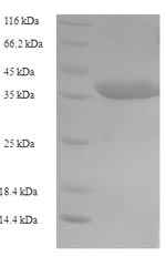 SDS-PAGE