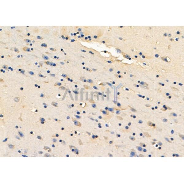 Валидация Affinity DF8464 - 20343