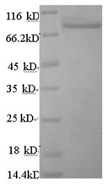 SDS-PAGE