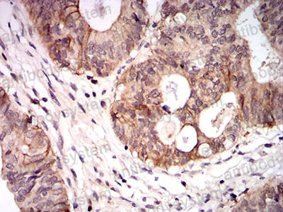 Валидация AntibodySystem RVV11602