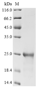 SDS-PAGE