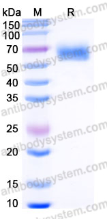 EHJ25701, SDS-PAGE