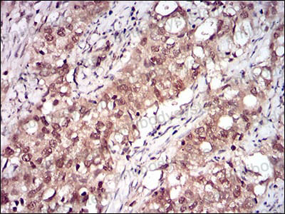 Валидация AntibodySystem RHF86206 (2711)