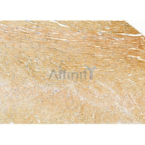 Валидация Affinity DF9325 - 21801