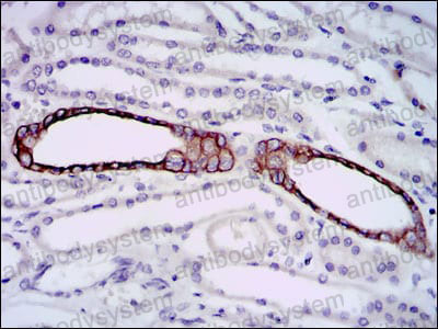 Валидация AntibodySystem RMN92901
