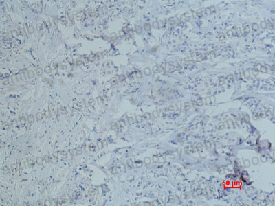 Валидация AntibodySystem RHC33013 (892)