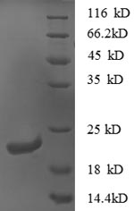 SDS-PAGE