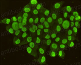 Валидация IF - AntibodySystem RHJ45305