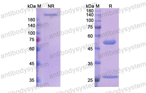 Валидация SDS-PAGE - AntibodySystem DVV00319