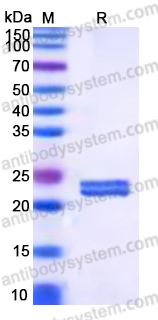 EHK99601, SDS-PAGE