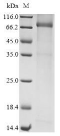 SDS-PAGE