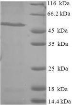 SDS-PAGE