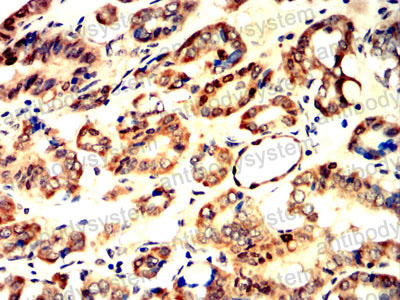 Валидация AntibodySystem RHN99402 (4048)