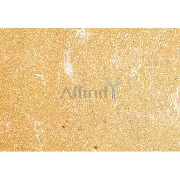 Валидация Affinity DF12005 - 6003