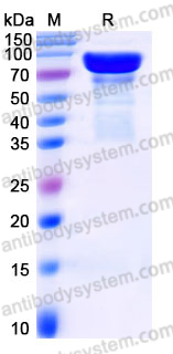 AHJ26301, SDS-PAGE