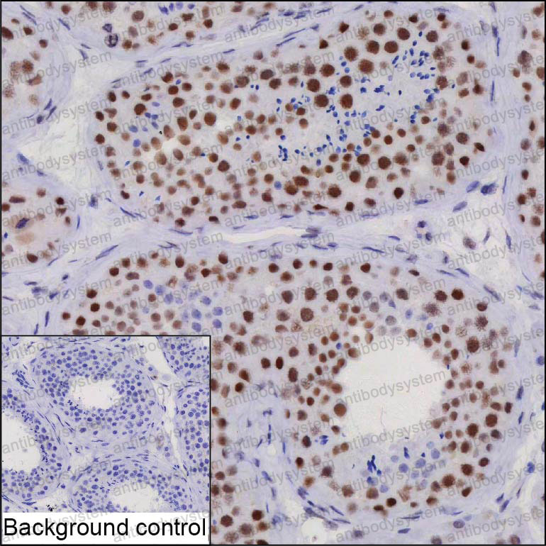Валидация AntibodySystem RHN74502