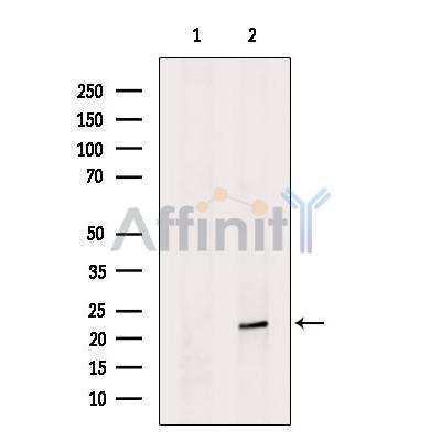 Валидация Affinity DF6249 - 17537