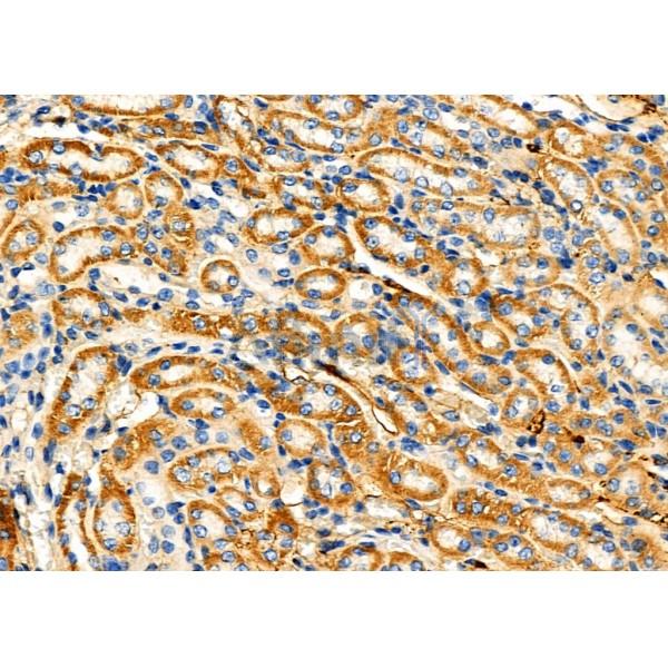 Валидация Affinity DF6611 - 18067