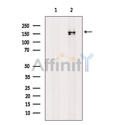Валидация Affinity DF9510 - 22145