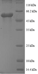 SDS-PAGE
