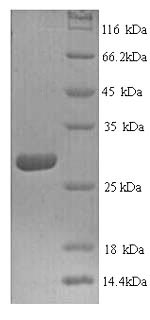 SDS-PAGE
